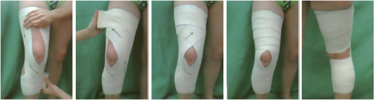 Bandage genou élastique